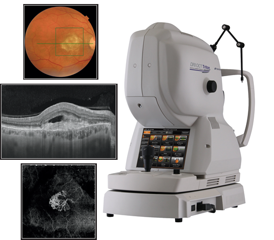 OPTİK KOHERENS TOMOGRAFİ (OKT/OCT) – Adana Retina